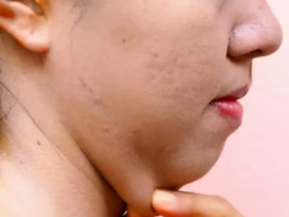 Comprehensive Facial Reconstruction