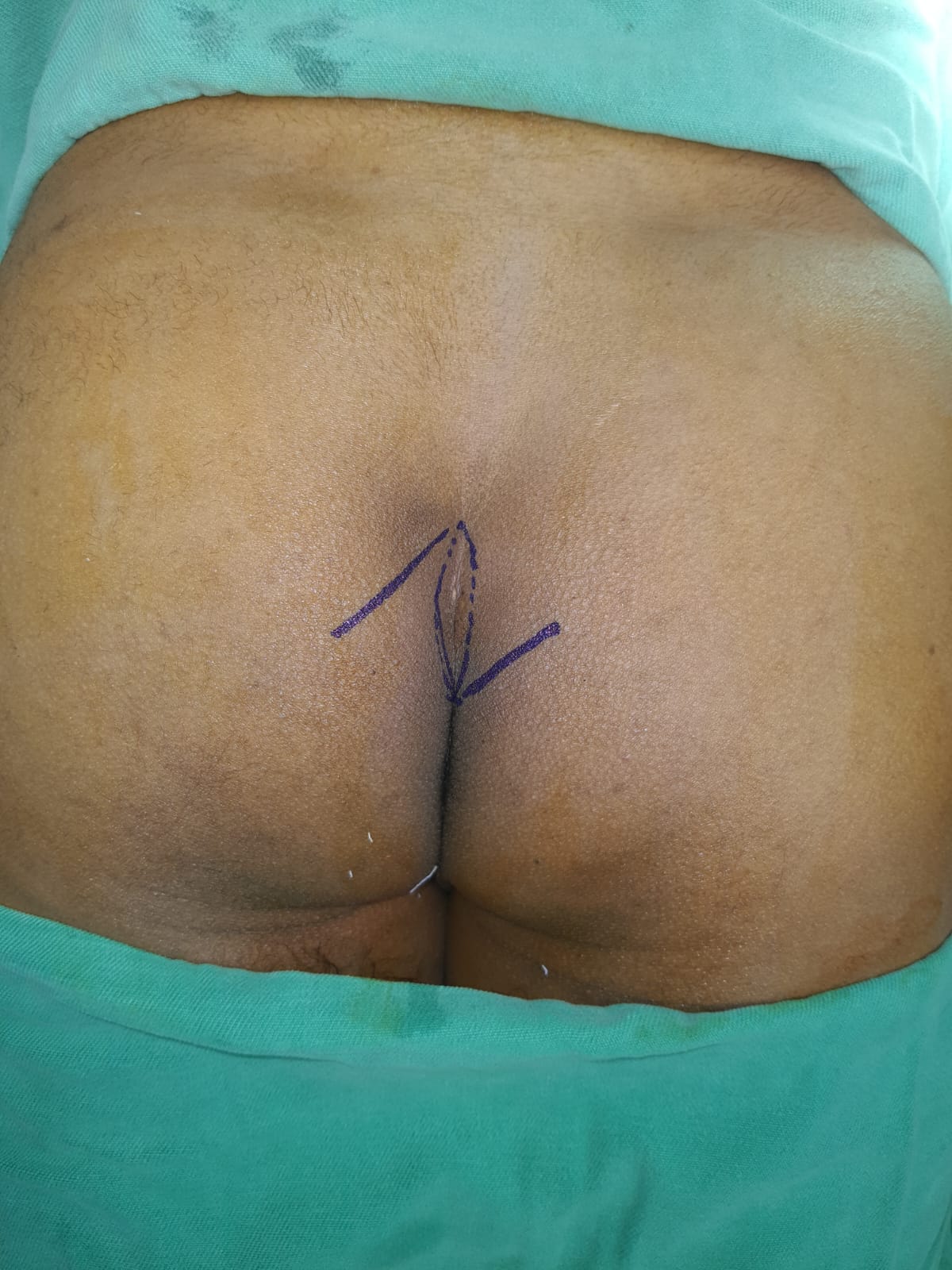 Post-Surgical Recovery