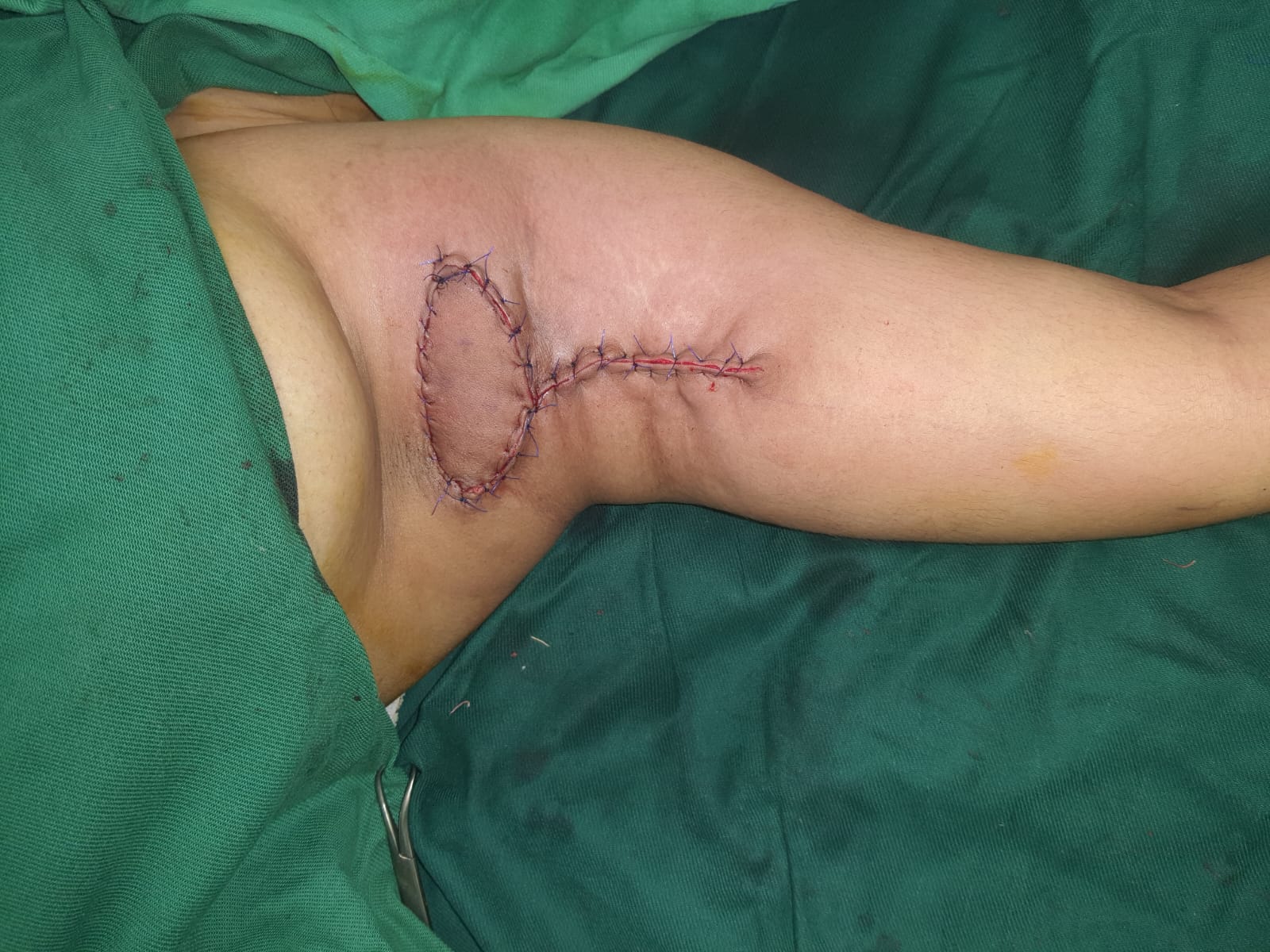 Pre-Operative Preparation